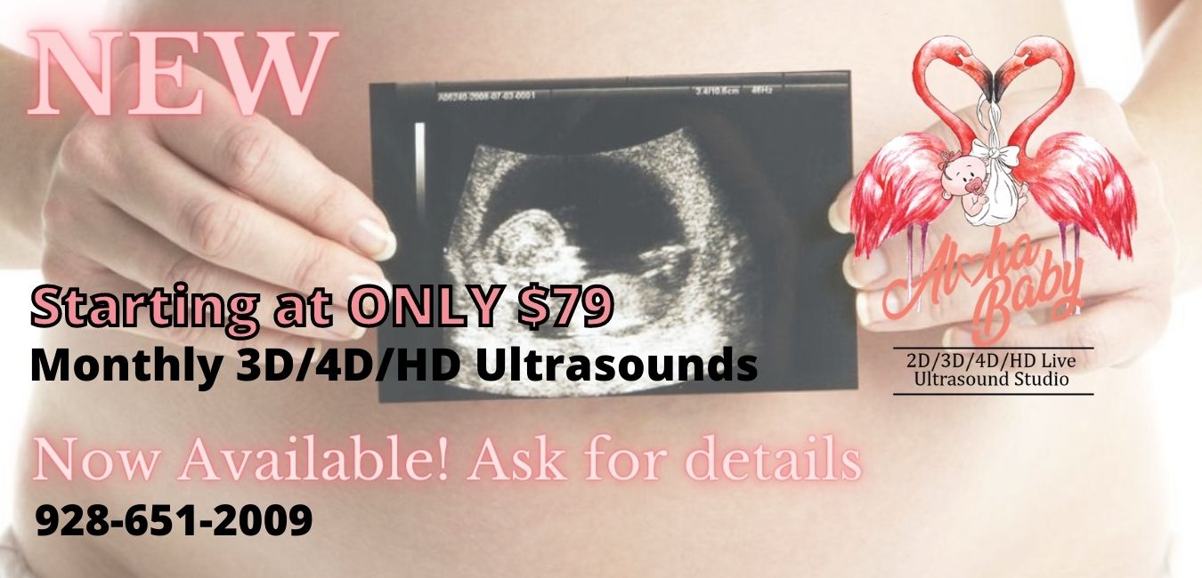 Aloha Baby Elective 3d/4d/Hd Live Ultrasound Studio logo